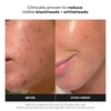Paula’s Choice SKIN PERFECTING 2% BHA Liquid Exfoliant(5 Fl Oz (Pack of 1))