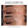 Paula’s Choice SKIN PERFECTING 2% BHA Liquid Exfoliant(5 Fl Oz (Pack of 1))