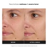 Paula’s Choice Niacinamide Face Toner, Combination or Oily Skin(Full Size – 6.4 Fl Oz)