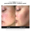 Paula’s Choice BOOST 10% Azelaic Acid Booster Cream Gel Serum(Travel Size – 0.17 Fl Oz)